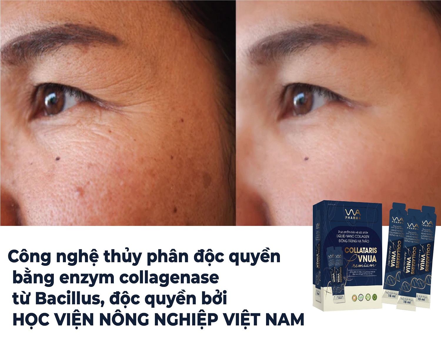 Collagen của Collataris VNUA Premium có hiệu quả không?